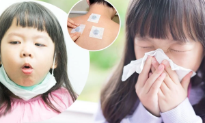 中醫學認為鼻敏感多是由臟腑虛損，正氣不足，腠理疏鬆，衛表不固，加上風寒之邪或異氣侵襲所致。
